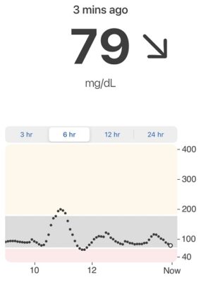 Dexcom CGM screenshot. Dexcom is one of 12 diabetes stocks on our list.