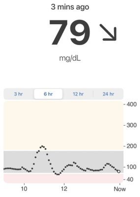 Dexcom CGM screenshot. Dexcom is one of 12 diabetes stocks on our list. 