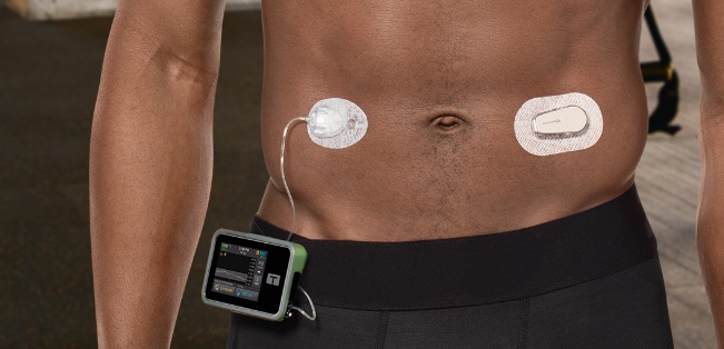Picture of Tandem t:slim next to a Dexcom G6. Two diabetes stocks featured in our list.